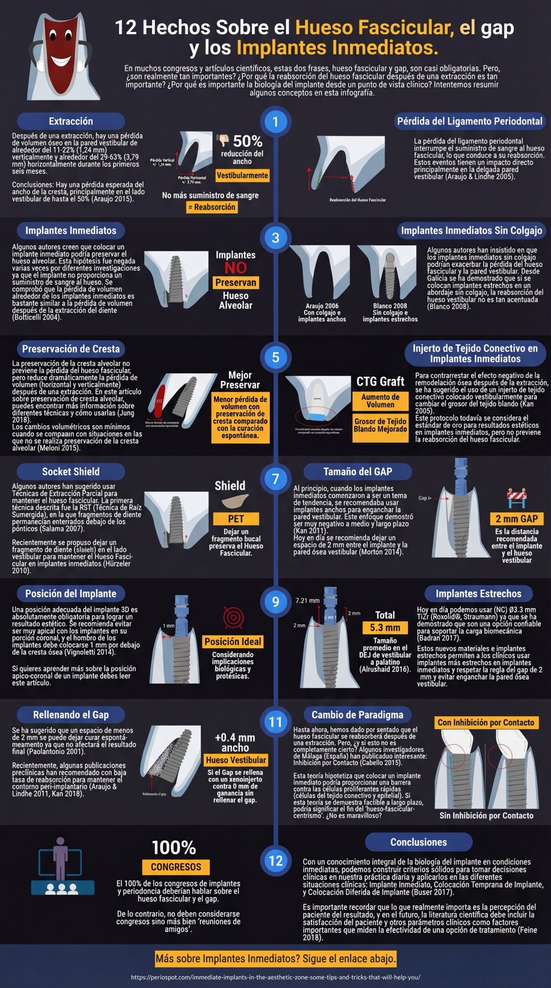 12 Hechos sobre el Hueso Fascicular (Bundle Bone), el Gap y los Implantes Inmediatos - Infografía completa en español: extracción y reabsorción, pérdida del ligamento periodontal, implantes inmediatos, preservación de cresta, injerto de tejido conectivo CTG, socket shield, tamaño del gap, posición del implante, implantes estrechos, relleno del gap, inhibición por contacto