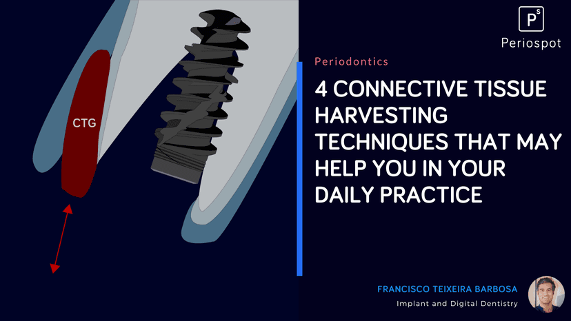4 connective tissue harvesting techniques that may help you in your daily practice
