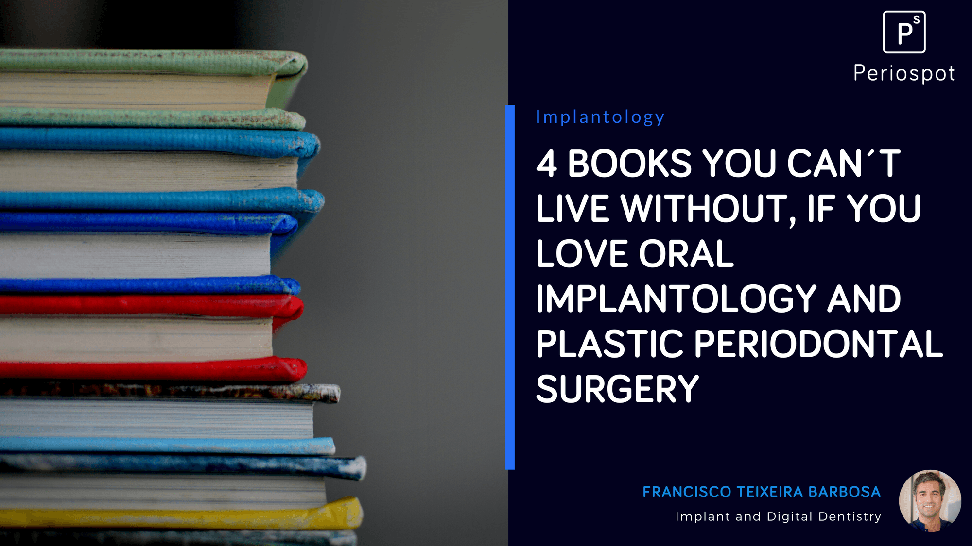 4 Implant Dentistry Books You Should Start Reading Today