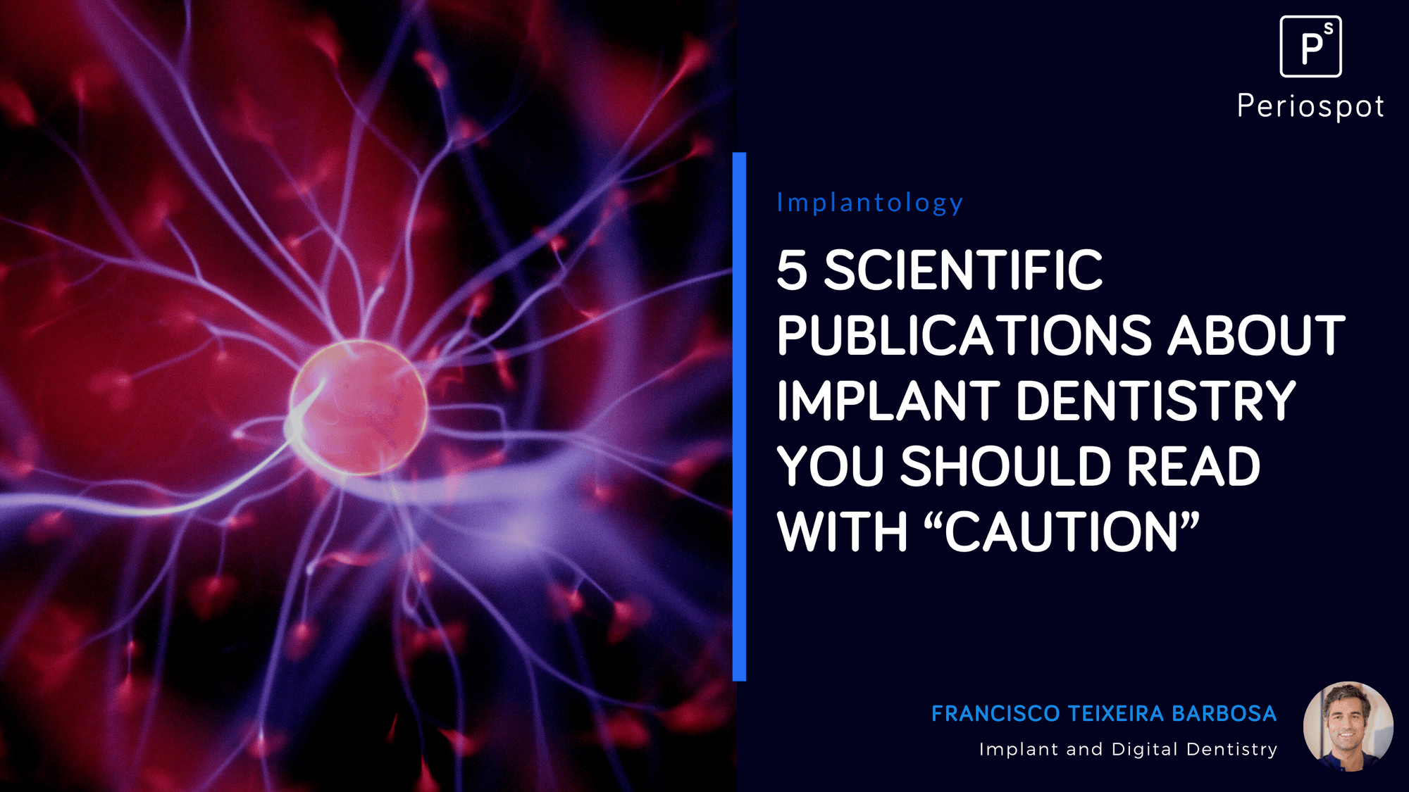 5 Important Scientific Publications About Implant Dentistry