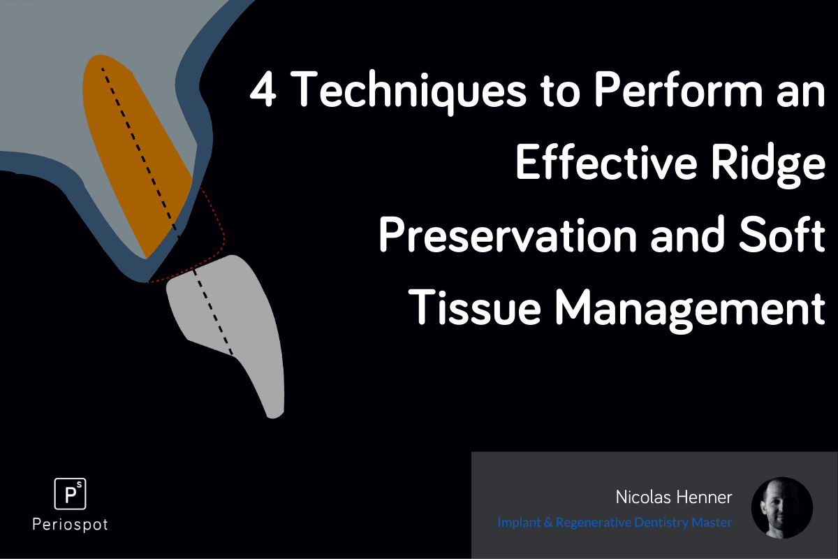 4 Techniques to Perform an Effective Ridge Preservation and Soft Tissue Management
