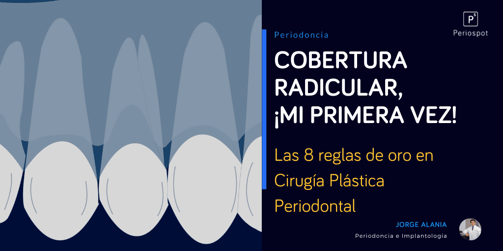 Cobertura Radicular, ¡Mi Primera Vez! Las 8 Reglas de Oro en Cirugía Plástica Periodontal.