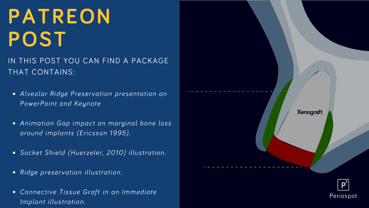 Alveolar Ridge Preservation- Presentation, animations, and illustrations