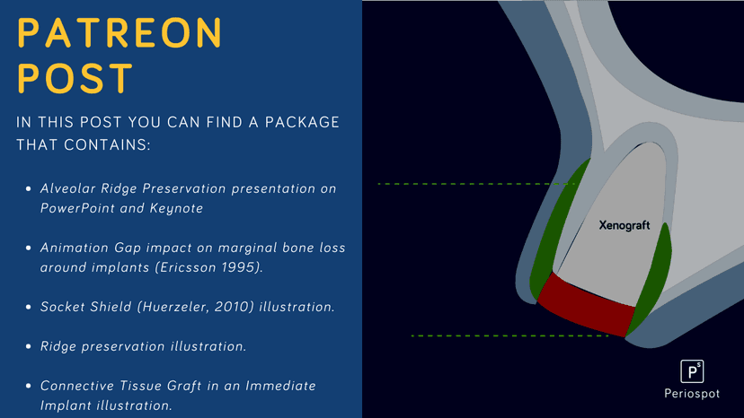 Alveolar Ridge Preservation- Presentation, animations, and illustrations