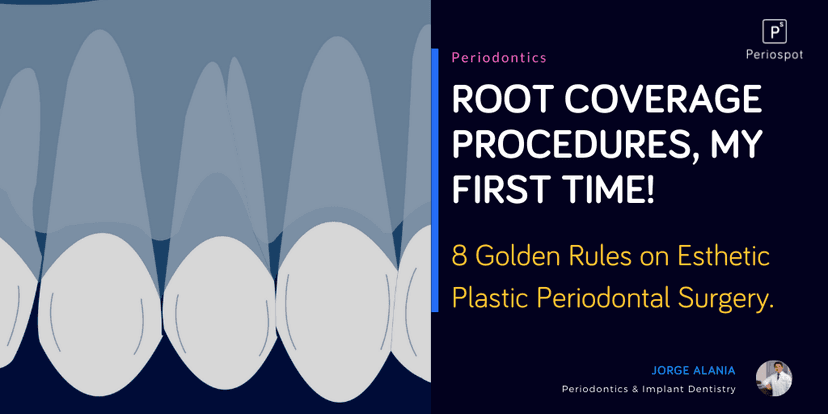 Root Coverage Procedures, My First Time! 8 Golden Rules on Esthetic Plastic Periodontal Surgery.