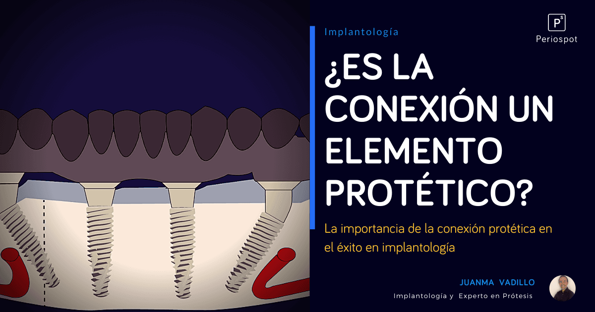 Será a Conexão é um Elemento Protético?