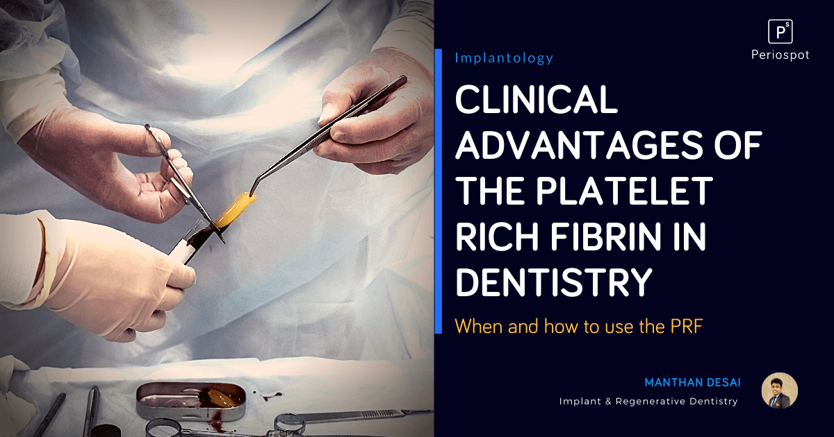 Clinical Advantages of the Platelet Rich Fibrin in Dentistry