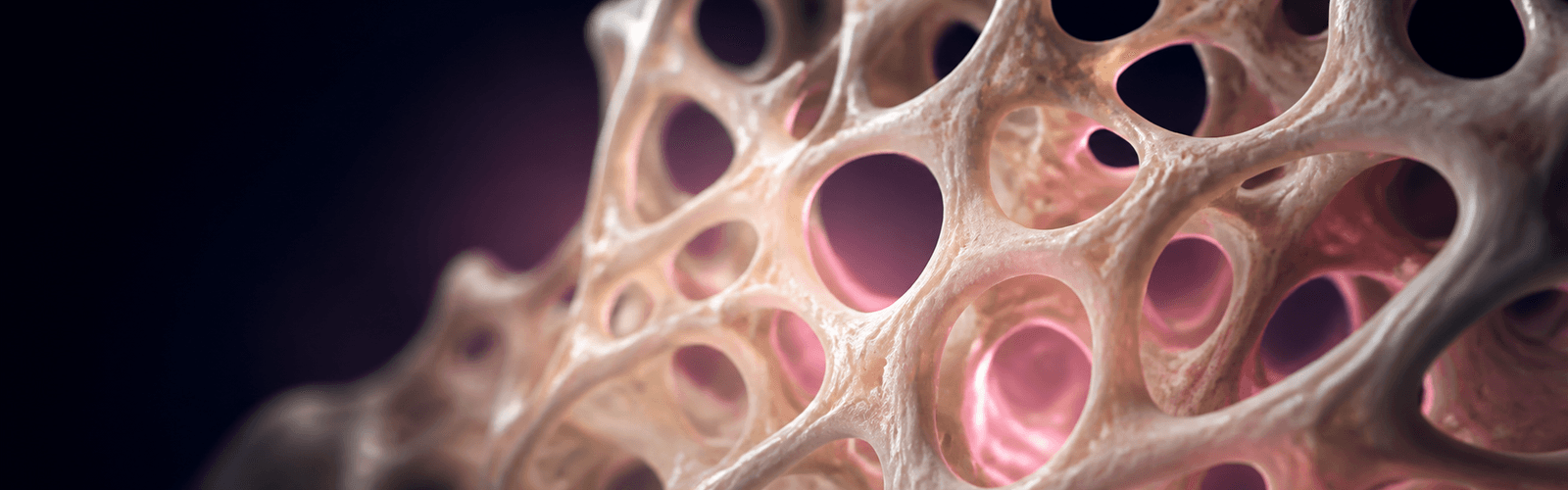 Abstract porous lattice evoking trabecular bone