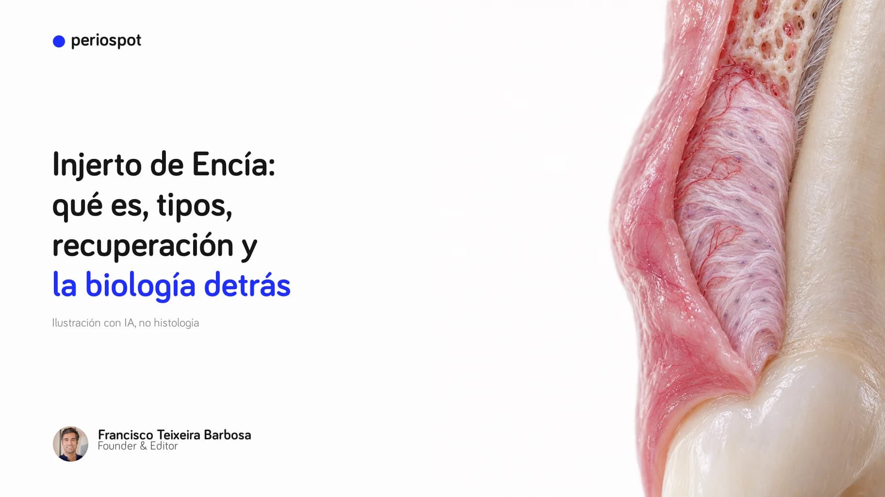 Injerto de Encía: qué es, tipos, recuperación y la biología detrás (ilustración con IA)