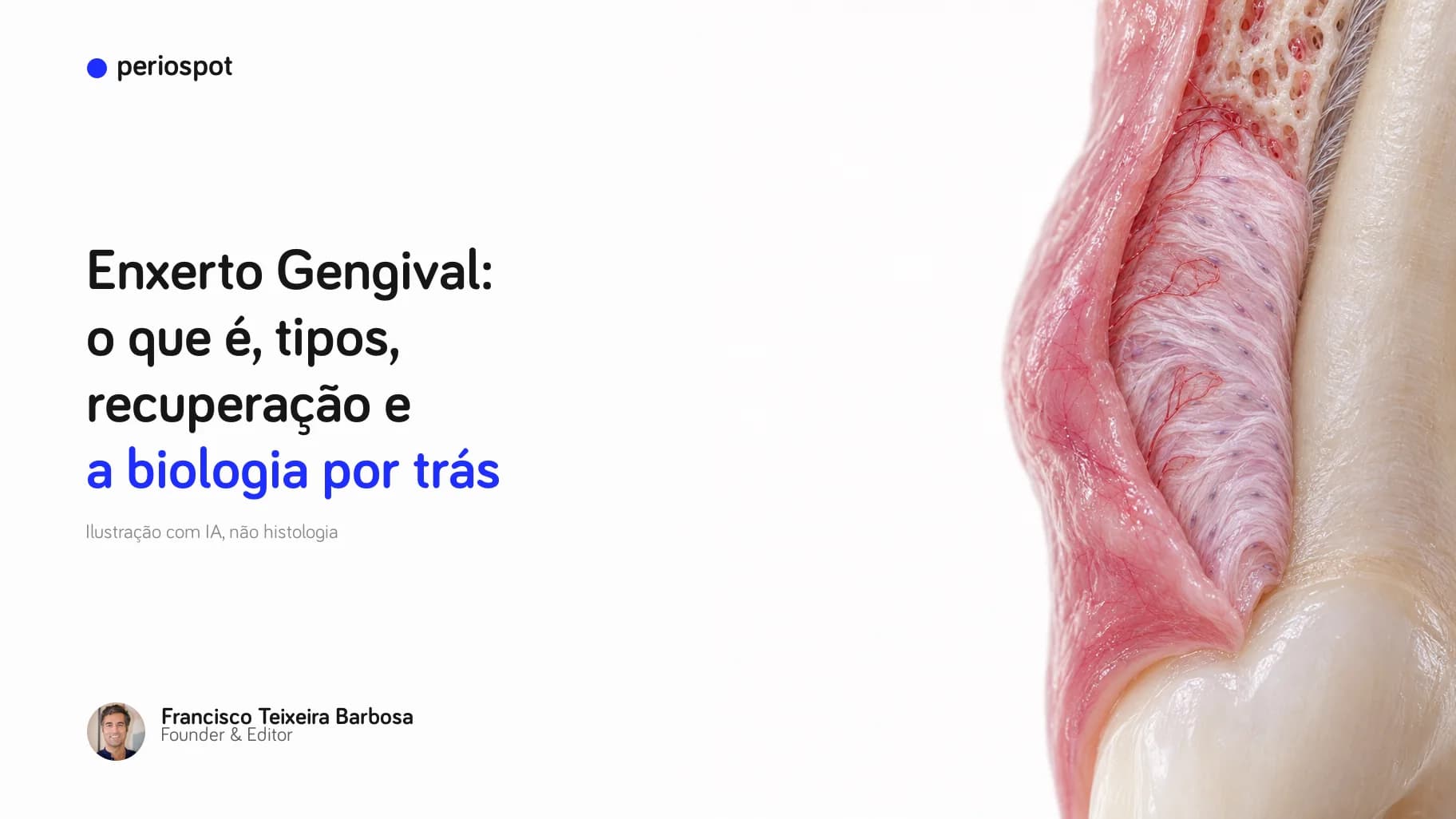 Enxerto Gengival: o que é, tipos, recuperação e a biologia por trás (ilustração com IA)