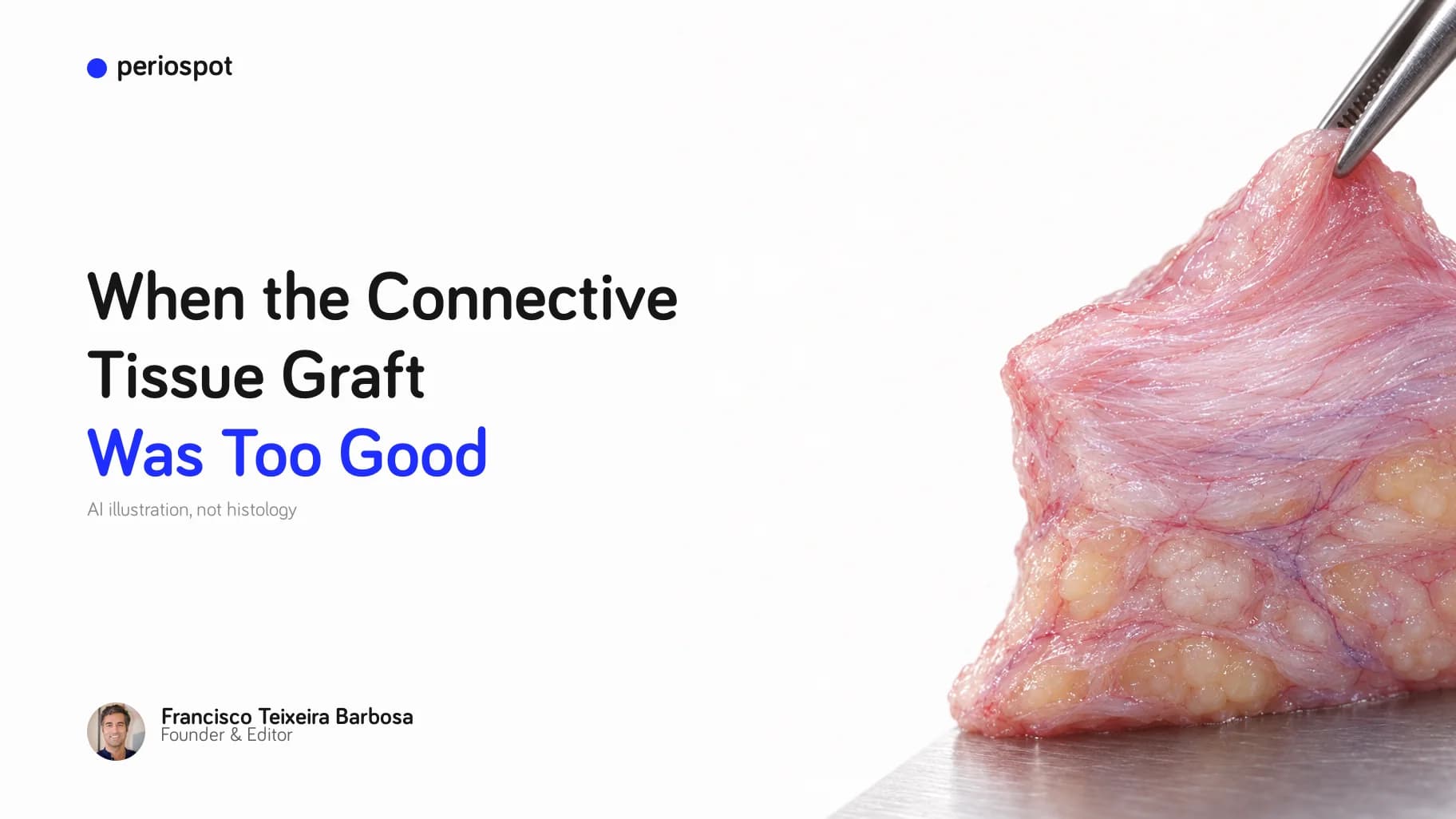 When the Connective Tissue Graft Was Too Good (AI illustration)