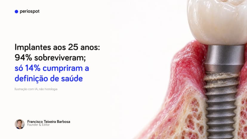 Implantes aos 25 anos: 94% sobreviveram; só 14% cumpriram a definição de saúde