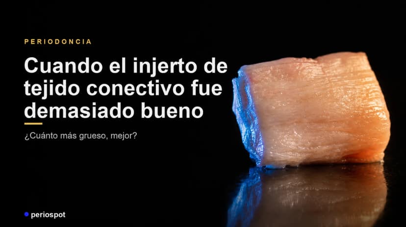 Cuando el injerto de tejido conectivo fue demasiado bueno
