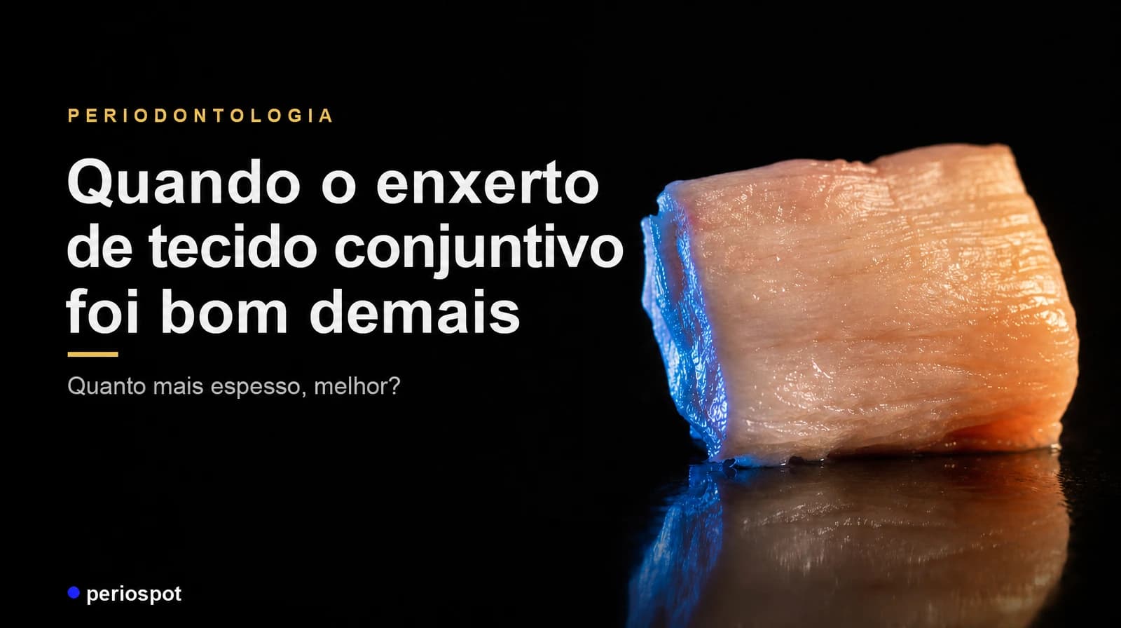 Quando o enxerto de tecido conjuntivo foi bom demais