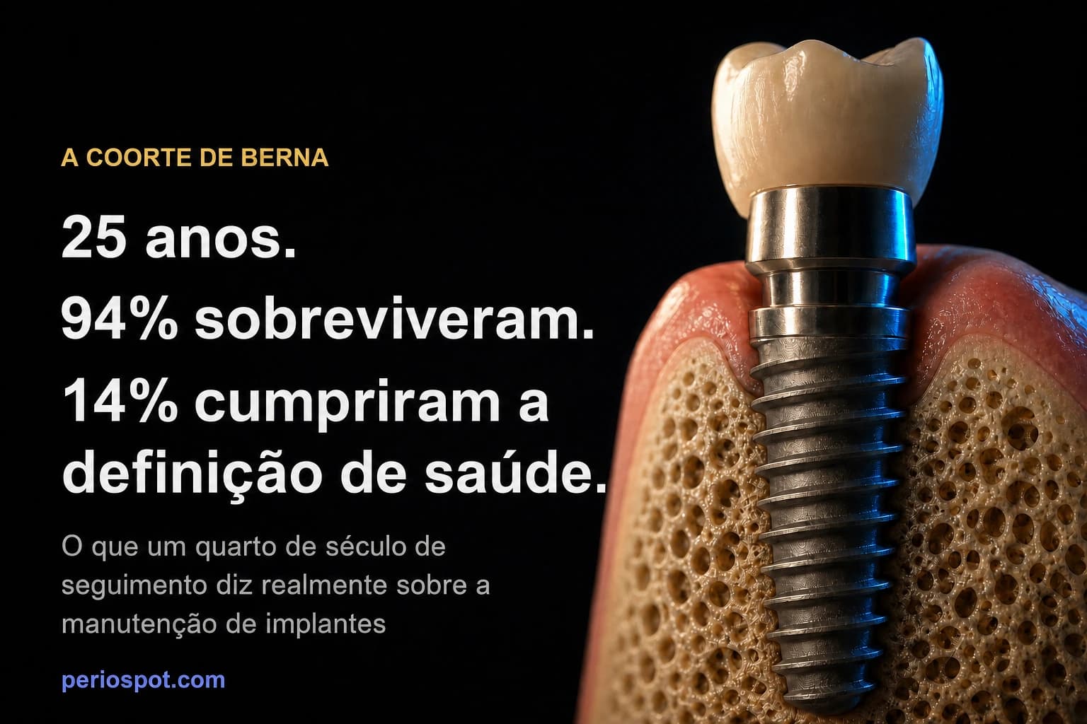 Implantes aos 25 anos: 94% sobreviveram; só 14% cumpriram a definição de saúde