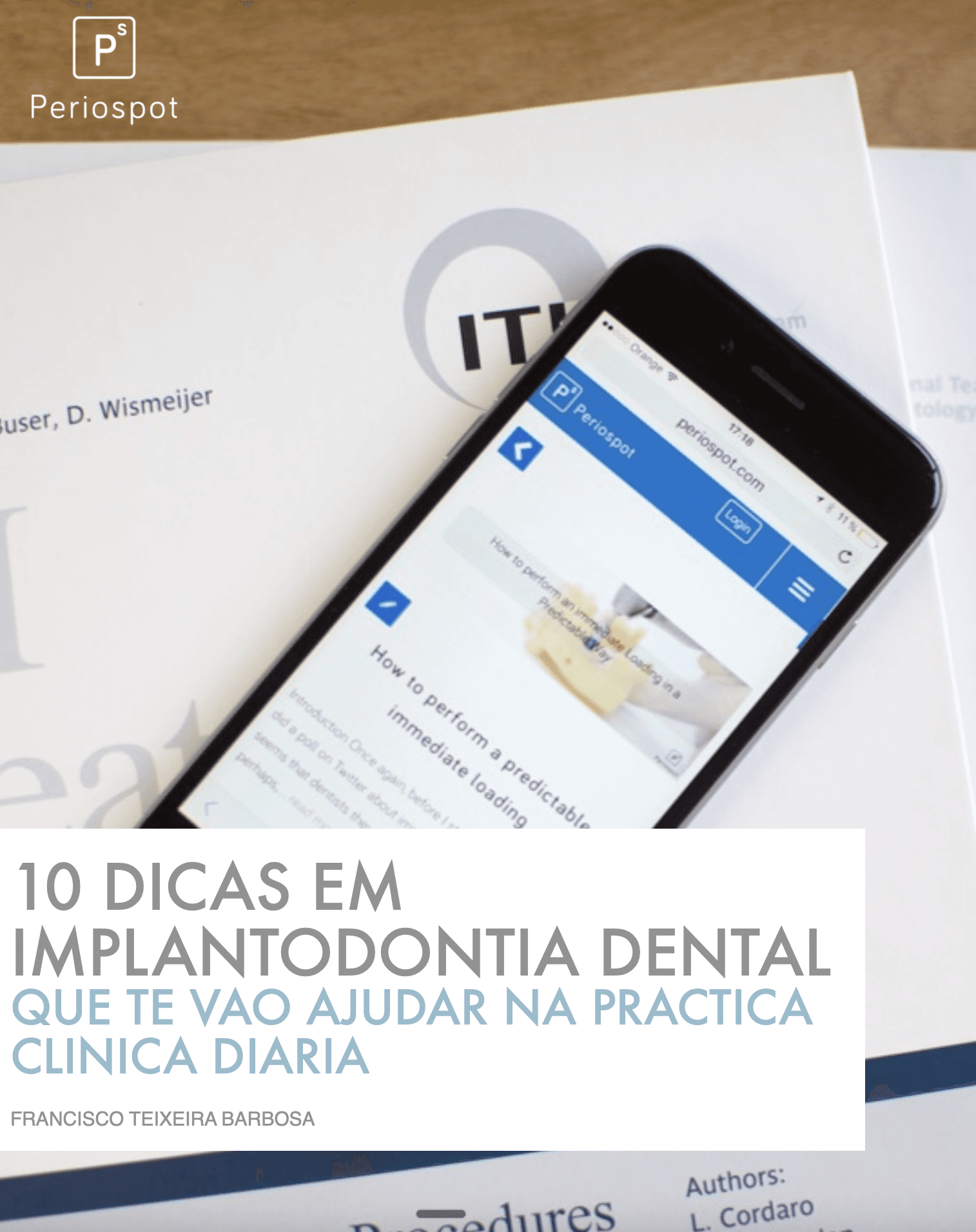 10 Dicas Sobre Implantologia Estética
