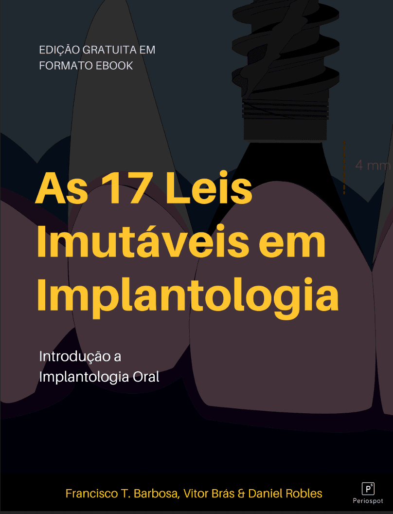 As 17 Leis Imutáveis da Implantologia