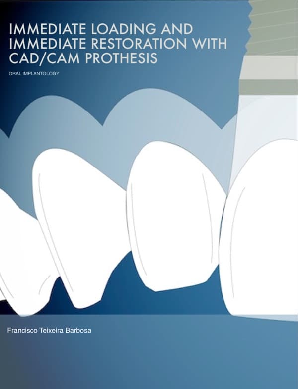 Immediate Loading and Immediate Restoration with CAD/CAM Prothesis
