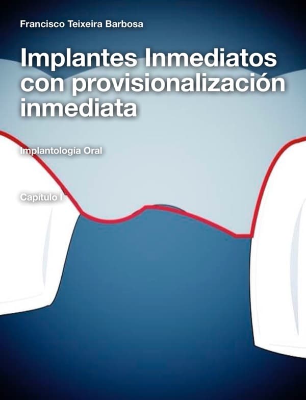 Implantologia Oral: Implantes Imediatos com Provisionalização Imediata