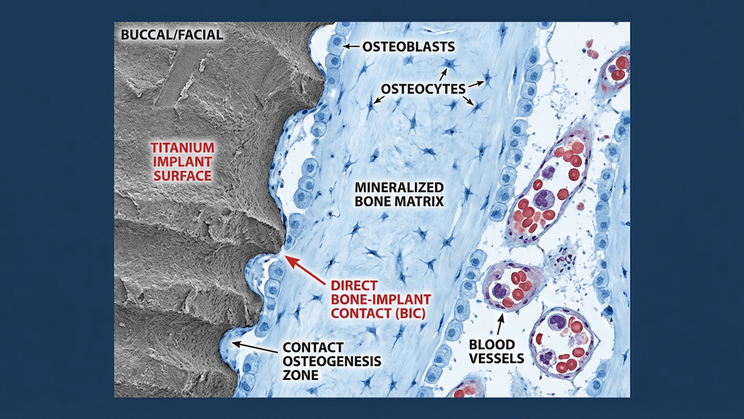 Bone-Implant Interface Microscopic View