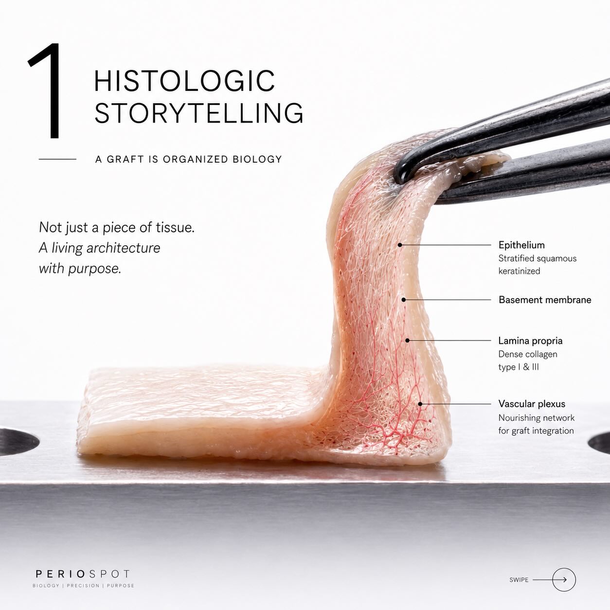Injerto de tejido conectivo como arquitectura viva: corte histológico con epitelio, colágeno, plexos vasculares, fibroblastos y matriz extracelular