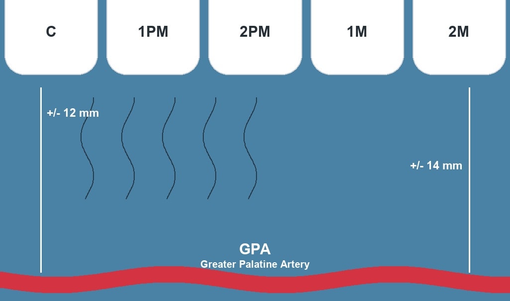Palatal anatomy and greater palatine artery landmarks for connective tissue graft harvesting
