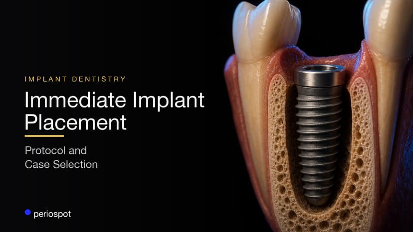 Immediate Implant Placement: A Protocol for Case Selection and Predictable Results