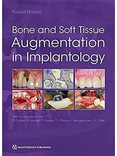 Bone and Soft Tissue Augmentation in Implantology