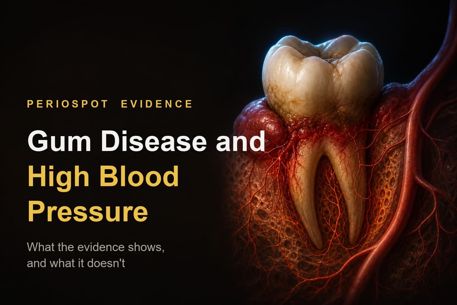 Gum Disease and High Blood Pressure: What the Evidence Actually Shows
