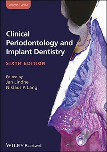 Implantes inmediatos, gap y hueso fascicular explicados en el libro de periodoncia de Lindhe