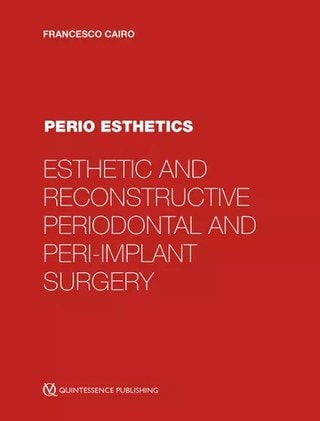 Perio Esthetics by Francesco Cairo