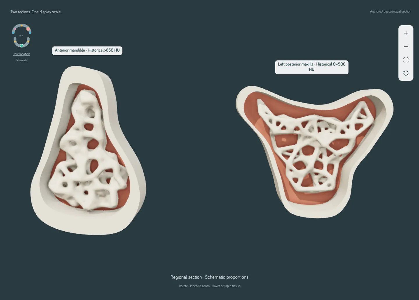 Two drawn jaw cross sections side by side at one display scale.