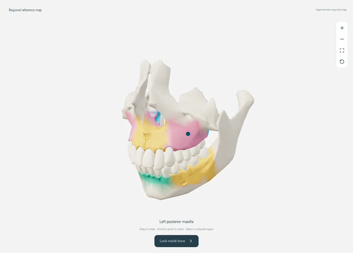 The Bone Quality Atlas jaw map, with the posterior maxilla selected and the regional colours showing.