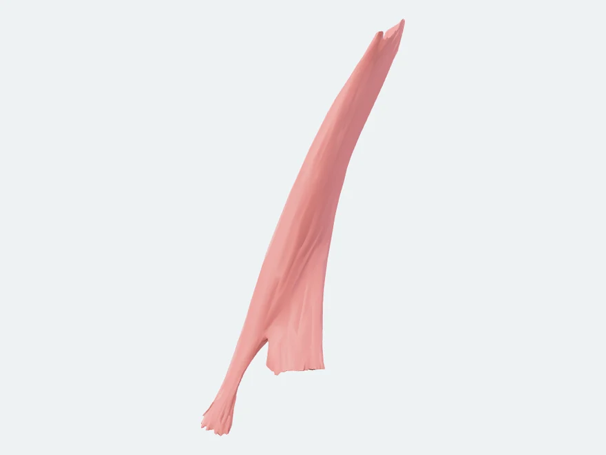 Left sternocleidomastoid, isolated in the atlas