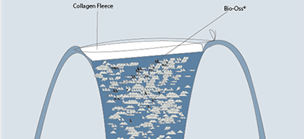 preservacion-crop-u32838