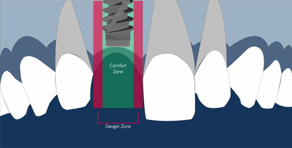 mesiodistal position