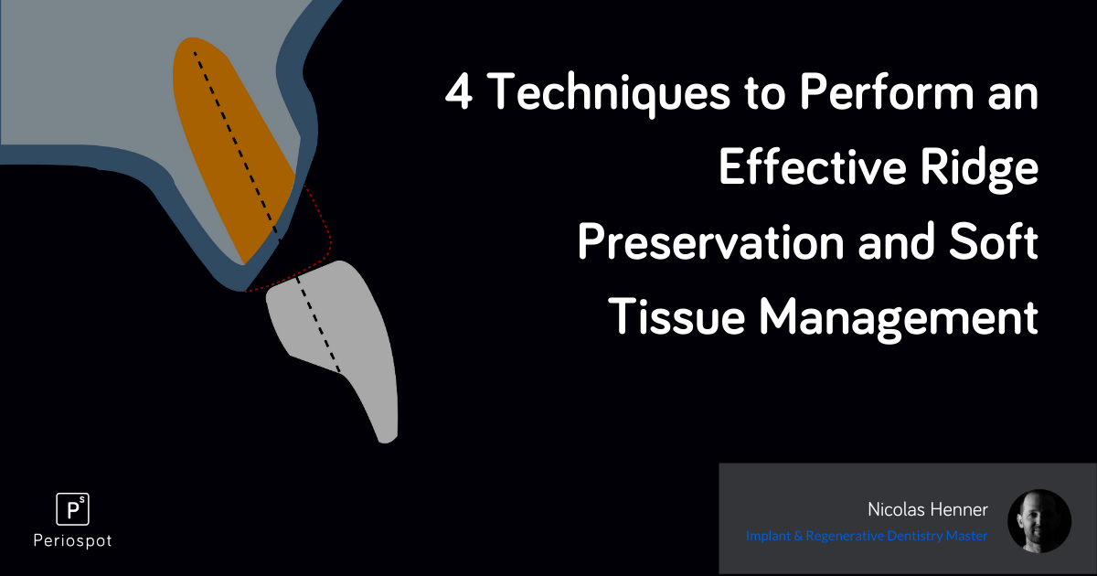 Recorving Ridges 4 Ridge Preservation and Soft Tissue Techniques | Periospot