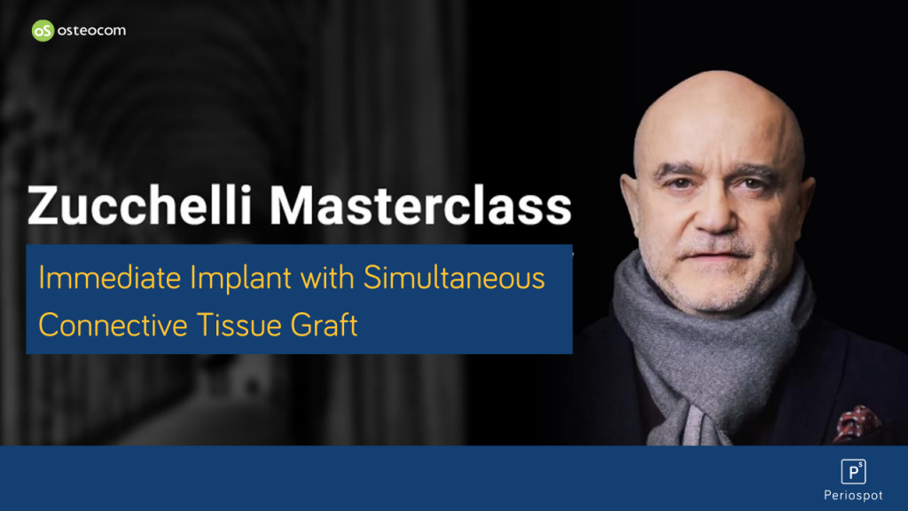Immediate Implant with Simultaneous Connective Tissue Graft