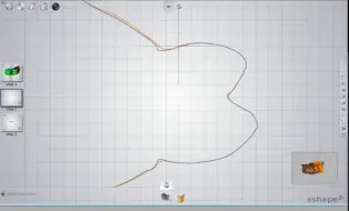 The two STL files merged on the posterior teeth in the analysis software.