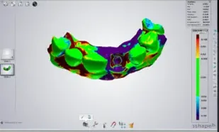 Color map of the volume change between the two scans.