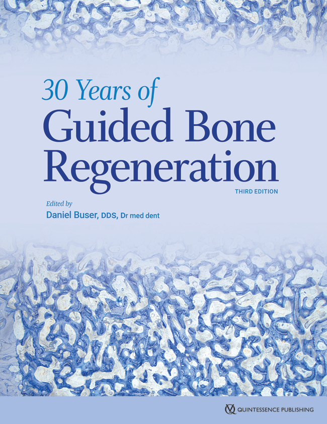 30 Years of Guided Bone Regeneration by Daniel Buser